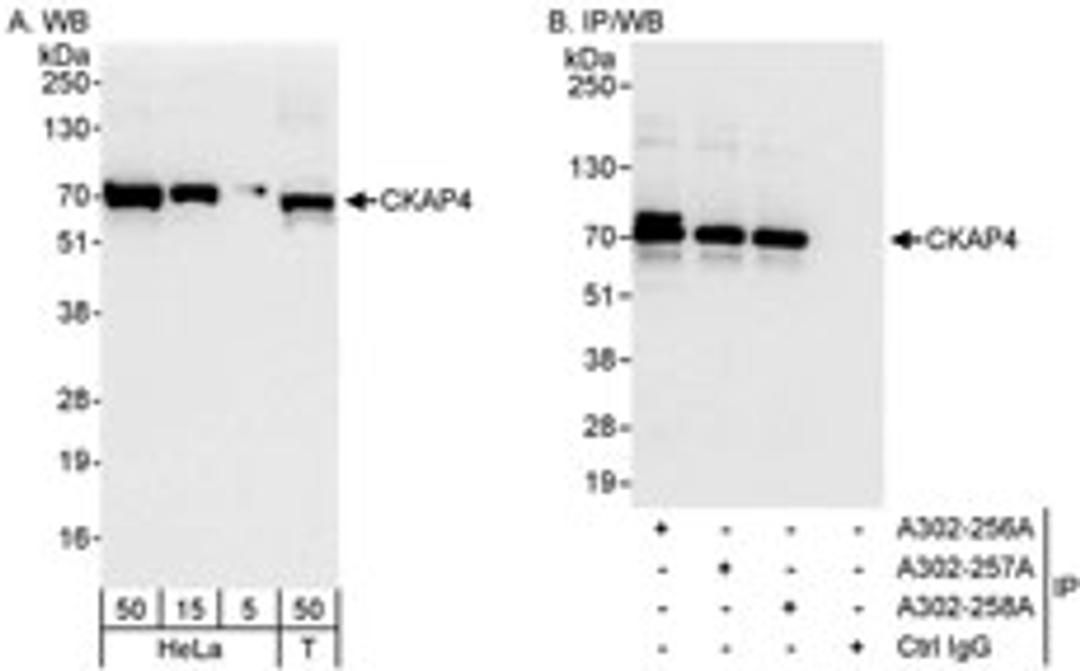 Detection of human CKAP4 by western blot and immunoprecipitation.