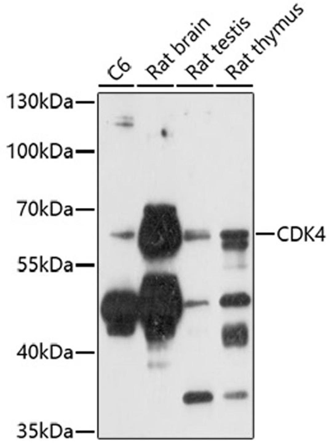 Western blot - CAMK4 antibody (A5304)