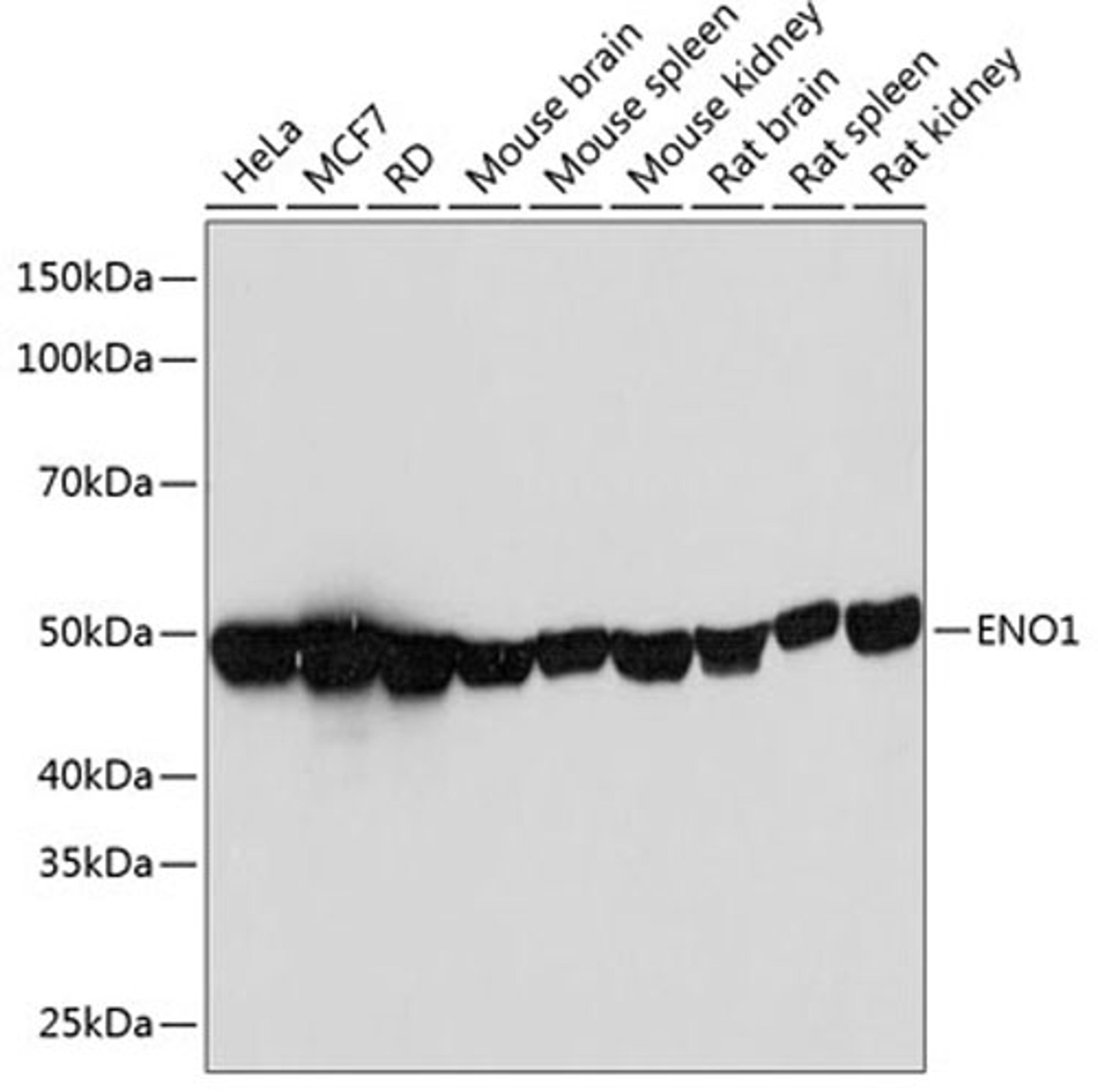 Western blot - ENO1 Rabbit mAb (A11448)