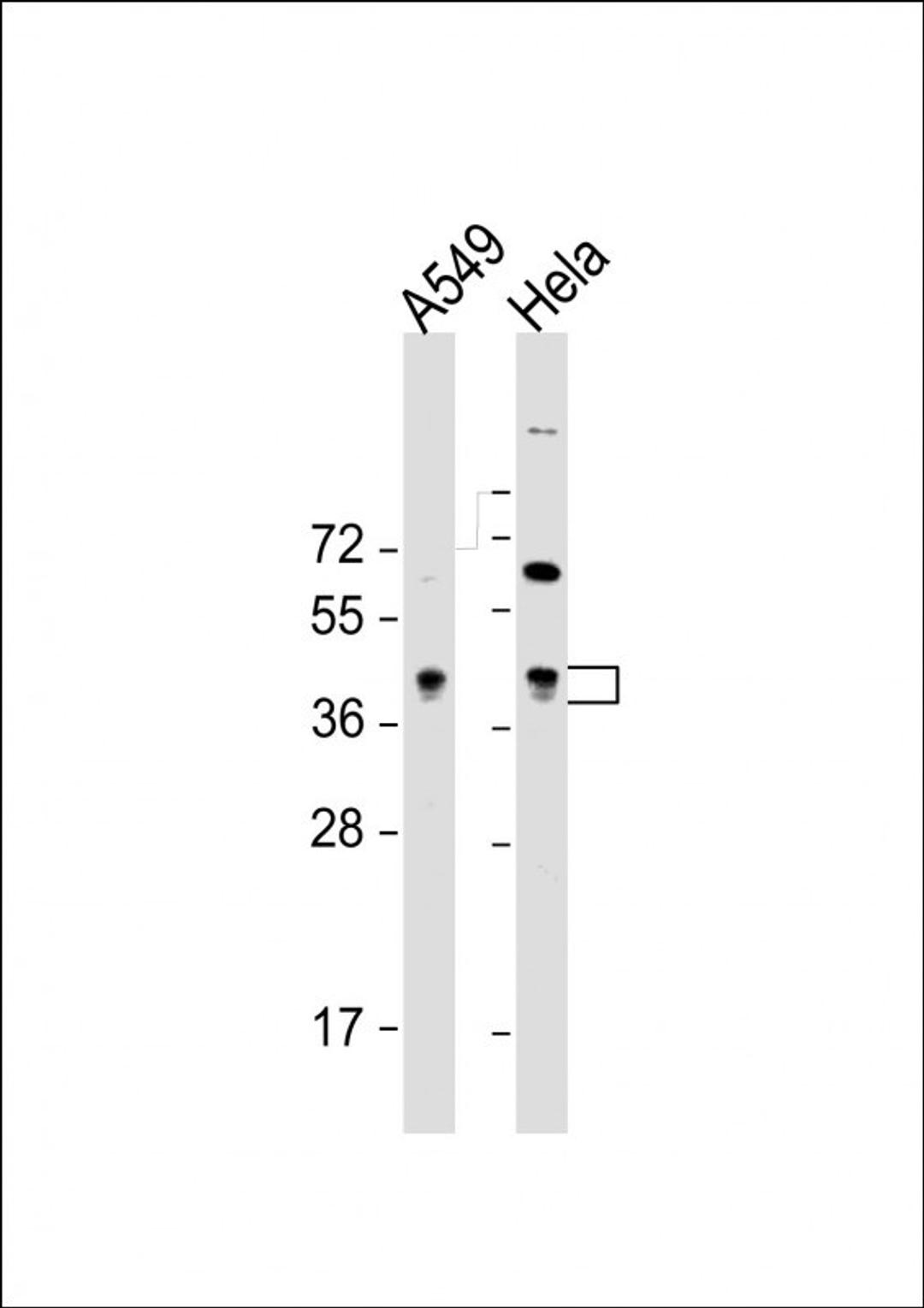 Western Blot at 1:8000 dilution Lane 1: A549 whole cell lysate Lane 2: Hela whole cell lysate Lysates/proteins at 20 ug per lane.