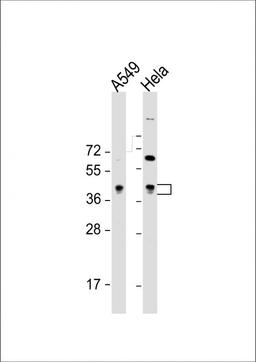 Western Blot at 1:8000 dilution Lane 1: A549 whole cell lysate Lane 2: Hela whole cell lysate Lysates/proteins at 20 ug per lane.