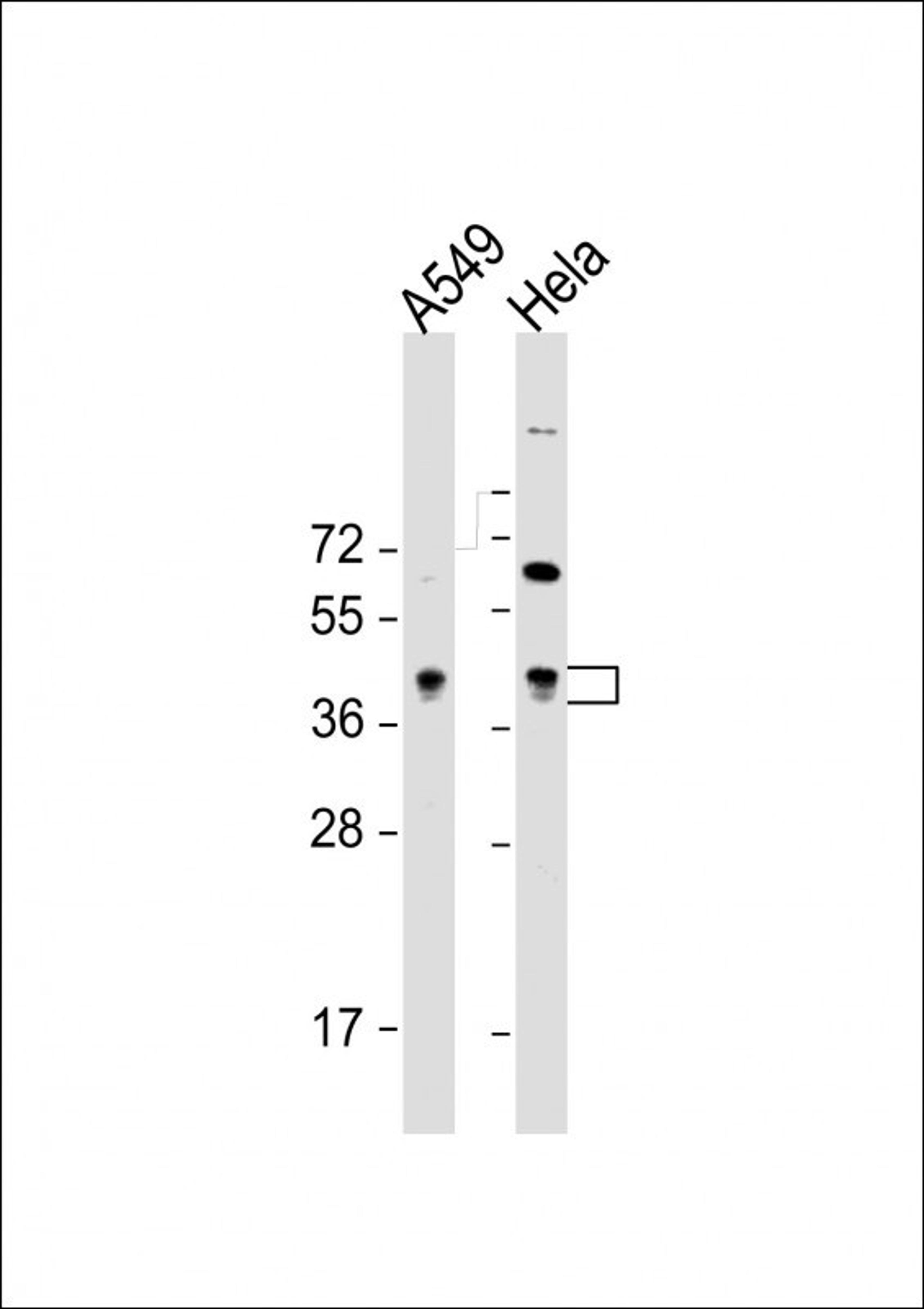 Western Blot at 1:8000 dilution Lane 1: A549 whole cell lysate Lane 2: Hela whole cell lysate Lysates/proteins at 20 ug per lane.