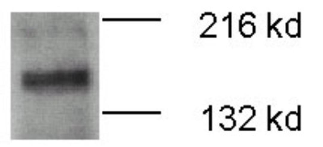 Western Blot: ATP7b Antibody [NB100-360] - ATP7b detected in 20 ug of mouse brain membrane fraction.