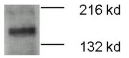 Western Blot: ATP7b Antibody [NB100-360] - ATP7b detected in 20 ug of mouse brain membrane fraction.