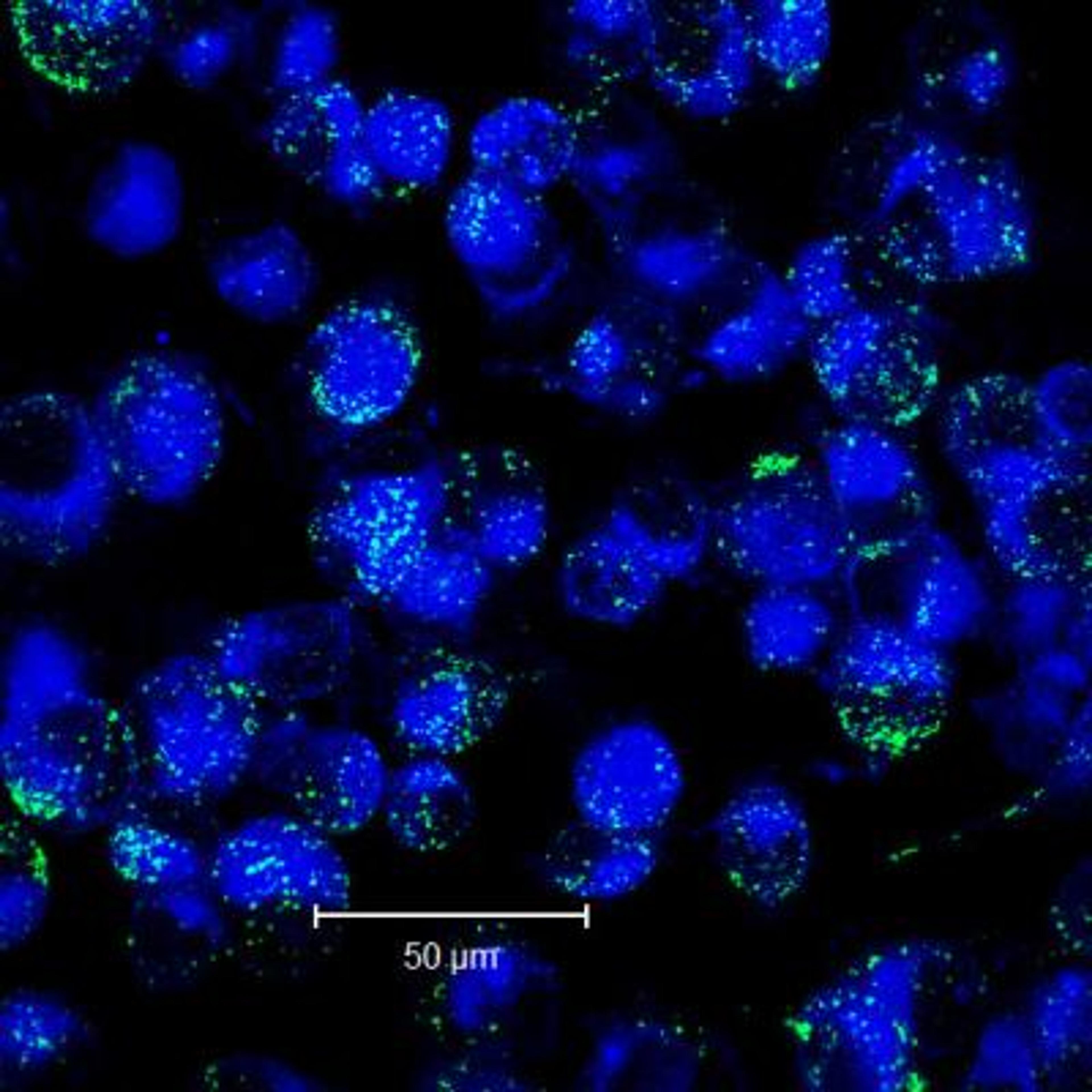 Immunocytochemistry/Immunofluorescence: Alkaline Phosphatase/ALPP Antibody (8B6) [NB110-3638] - analysis of ALPP in MDA-MB-231 cells using an anti-ALPP antibody (blue - cell membrane, green - ALPP). Image from verified customer review.