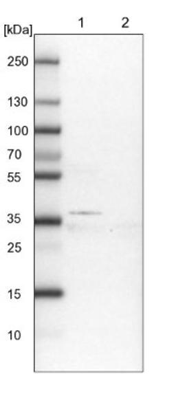 Western Blot: TMEM164 Antibody [NBP1-93939] - Lane 1: NIH-3T3 cell lysate (Mouse embryonic fibroblast cells)<br/>Lane 2: NBT-II cell lysate (Rat Wistar bladder tumour cells)