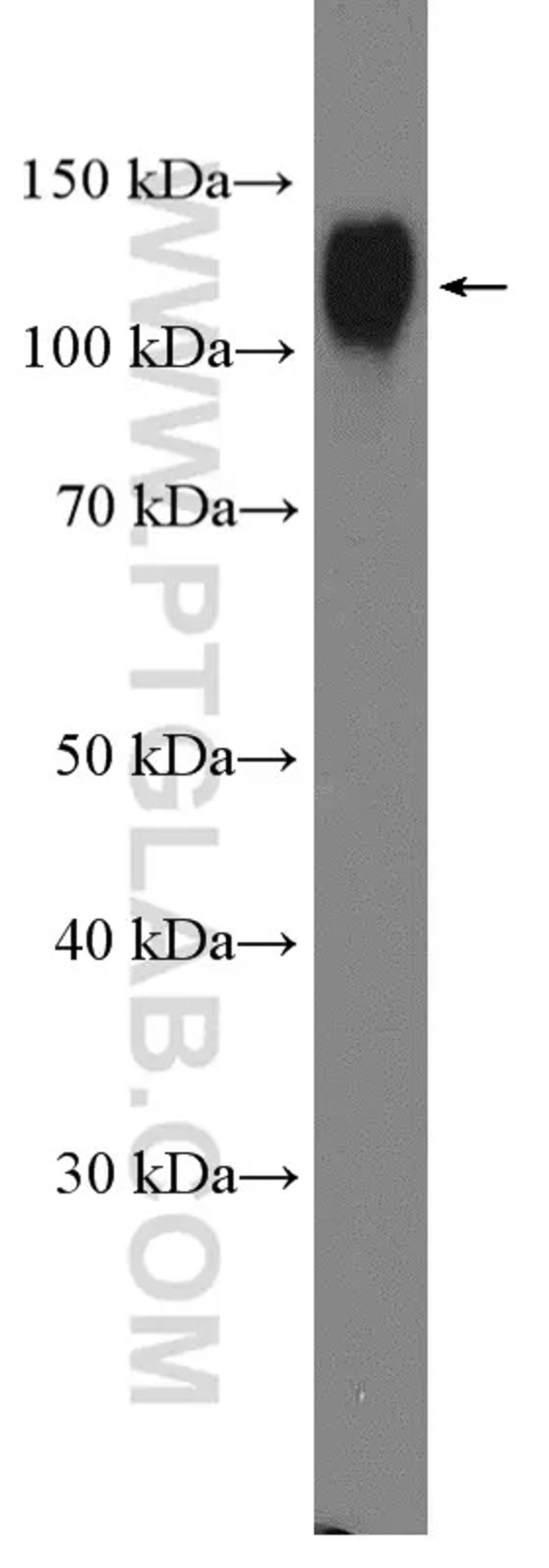 WB analysis of U-937 using 21997-1-AP