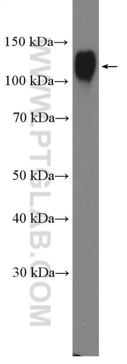 WB analysis of U-937 using 21997-1-AP