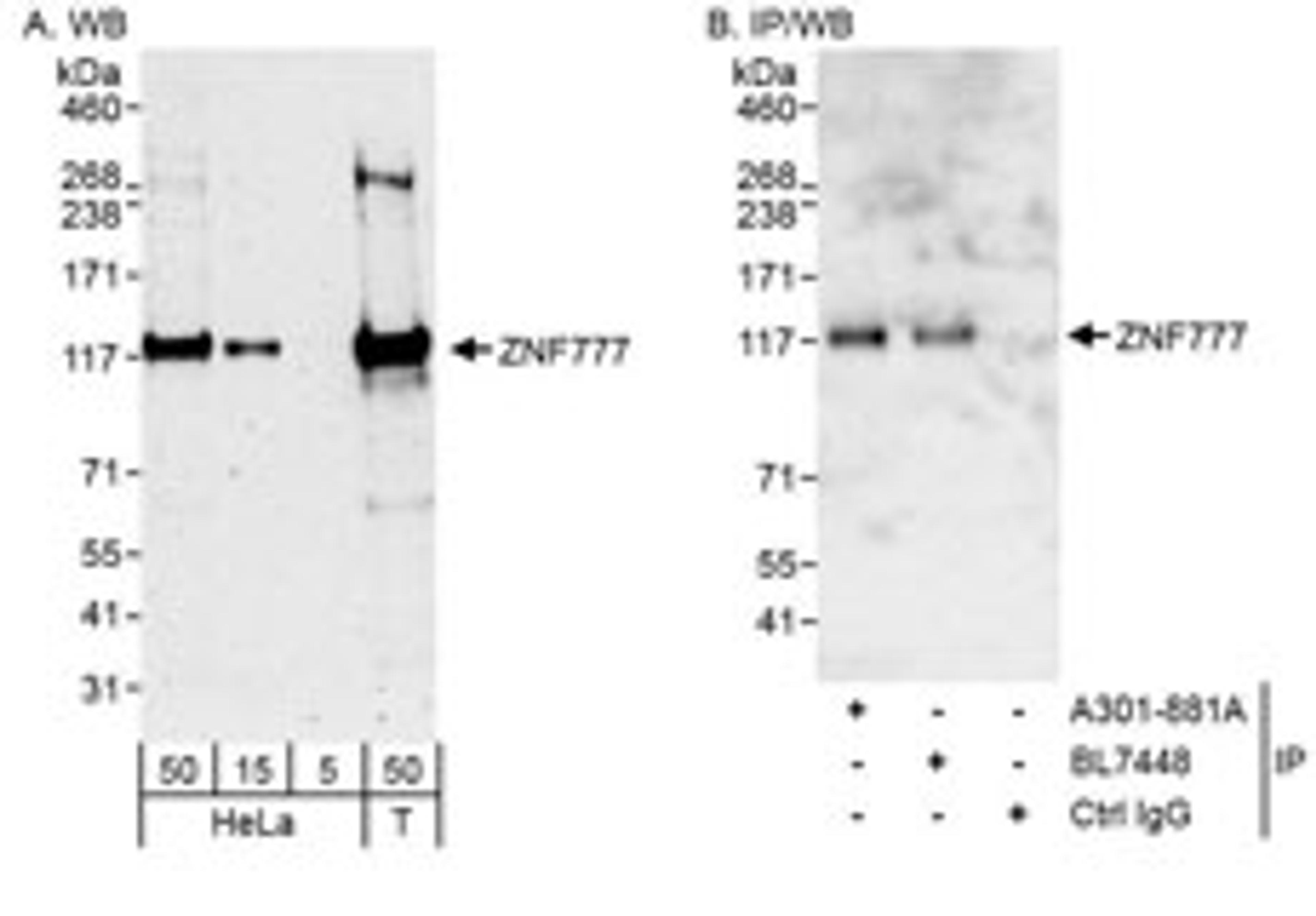 Detection of human ZNF777 by western blot and immunoprecipitation.