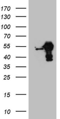 Western Blot: RBMS1 Antibody (2H1) [NBP2-45533] - Analysis of HEK293T cells were transfected with the pCMV6-ENTRY control (Left lane) or pCMV6-ENTRY RBMS1.