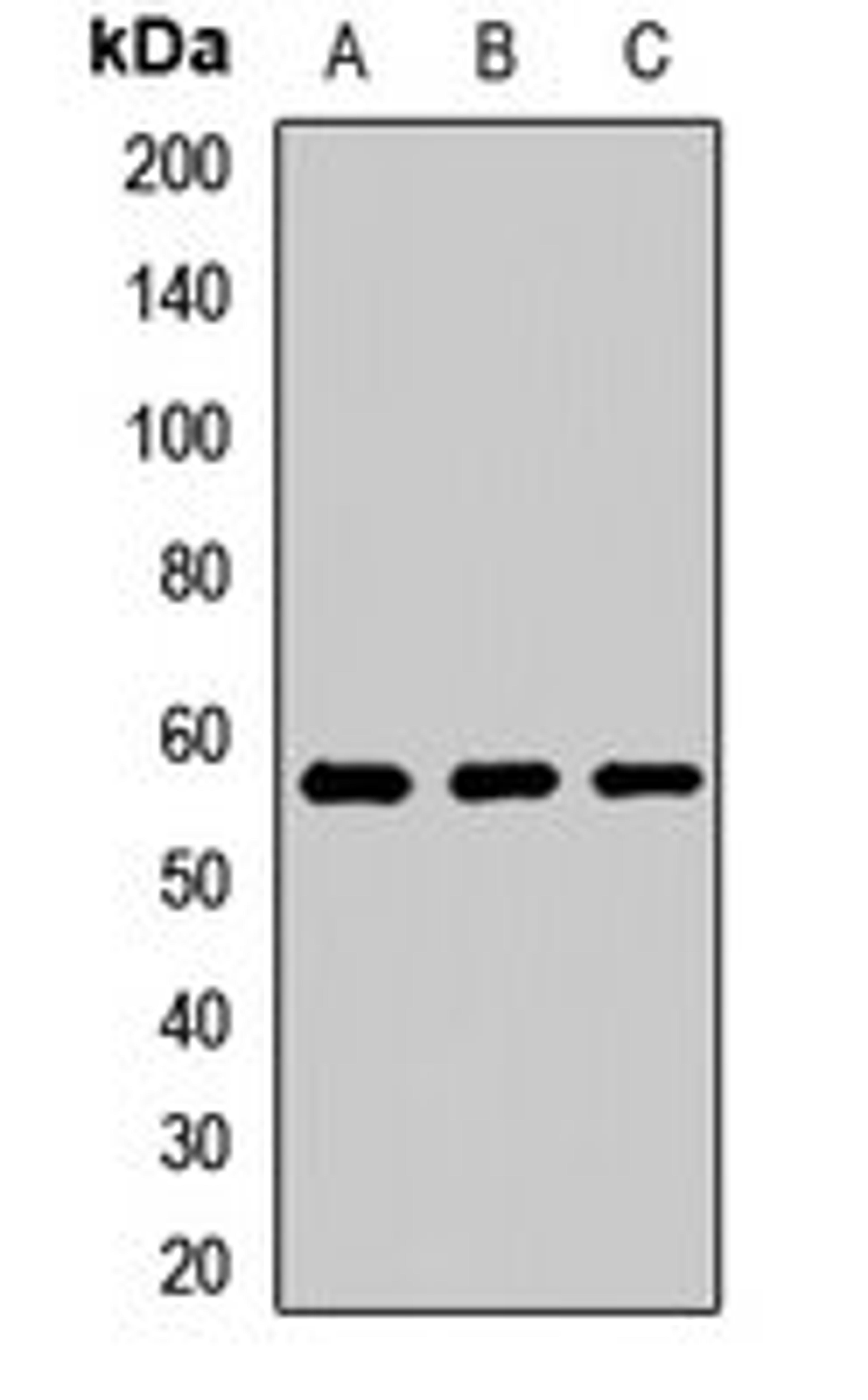 Western blot analysis of A431 (Lane1), HT29 (Lane2), mouse liver (Lane3) whole cell lysates using SMU1 antibody