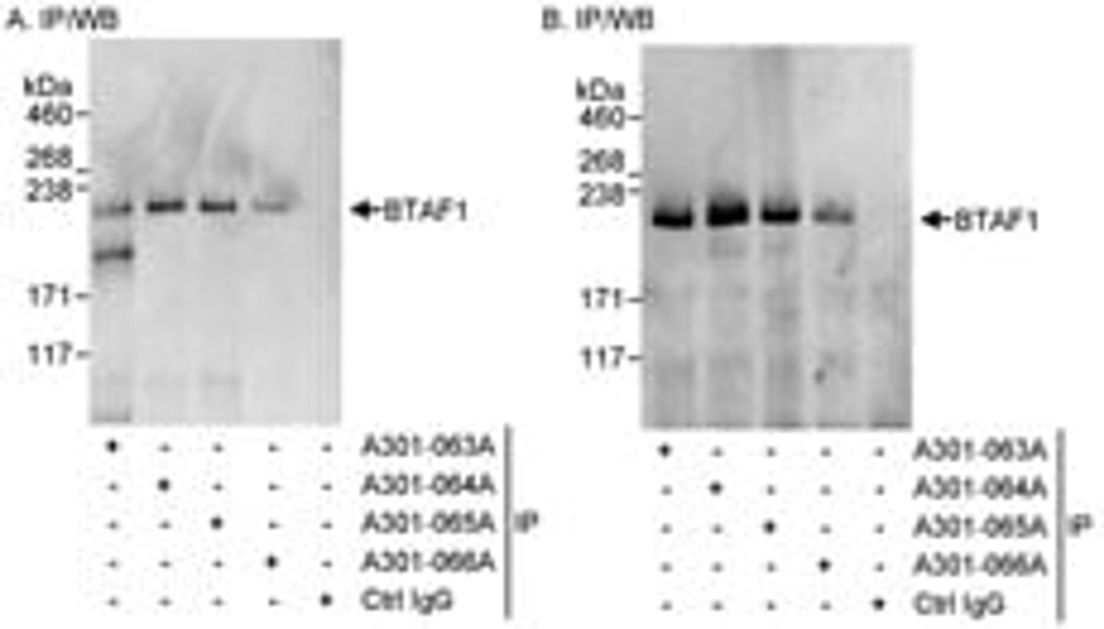 Detection of human BTAF1 by western blot of immunoprecipitates.