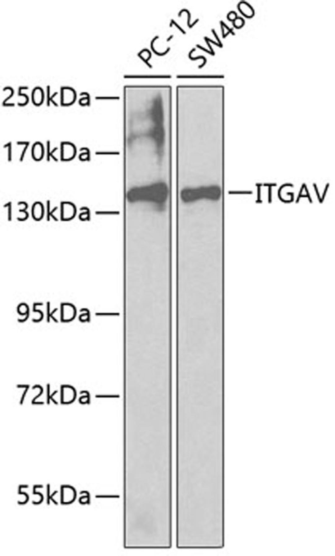 Western blot - ITGAV antibody (A2091)