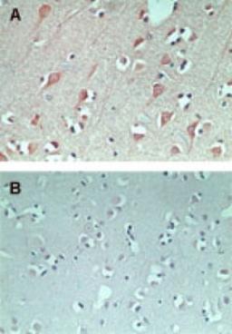 Immunohistochemistry-Paraffin: FAM3C Antibody [NBP2-24464] - staining of FAM3C using FAM3C antibody in normal human brain at 5 ug/ml (using control rabbit Ig for figure B).