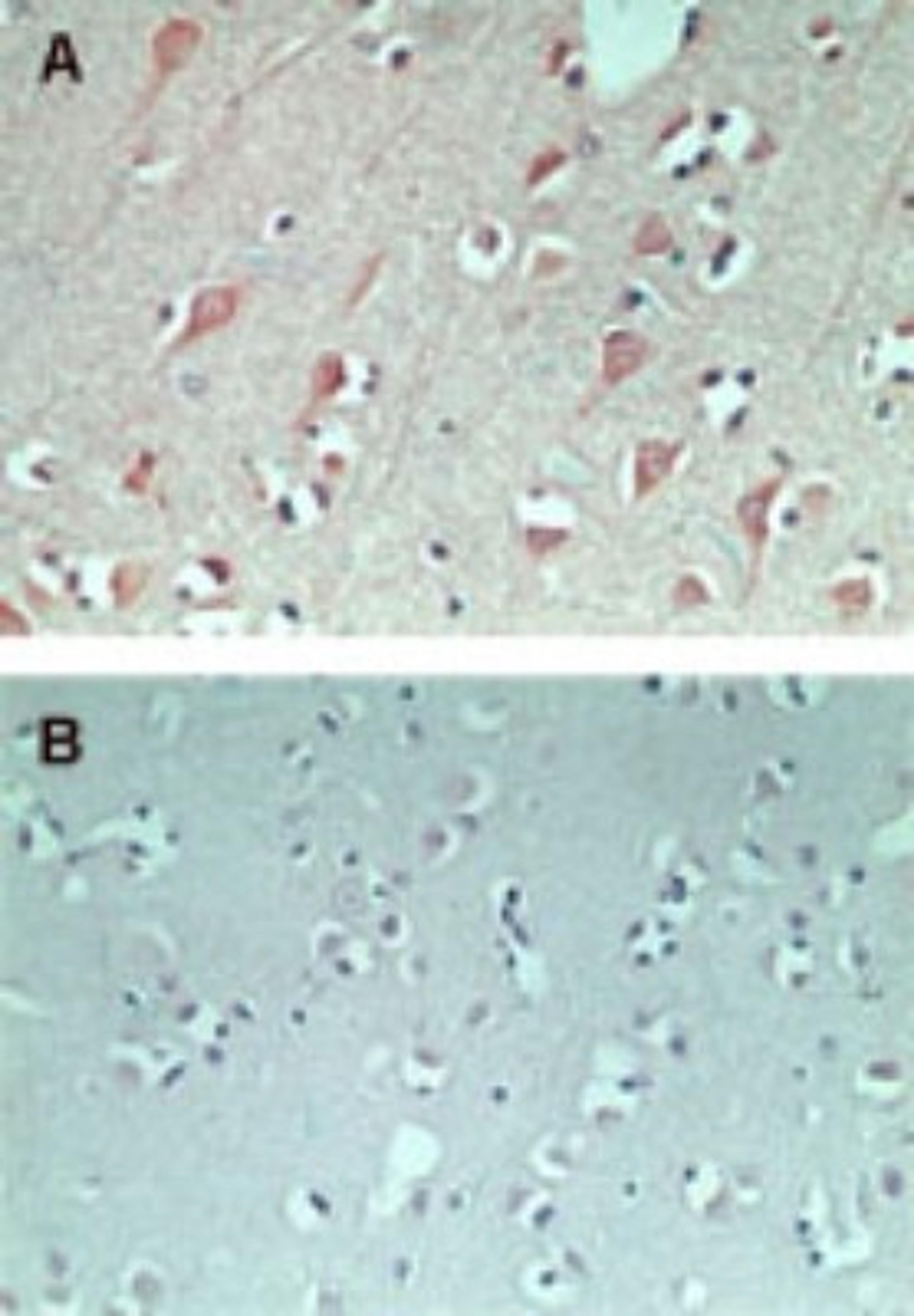 Immunohistochemistry-Paraffin: FAM3C Antibody [NBP2-24464] - staining of FAM3C using FAM3C antibody in normal human brain at 5 ug/ml (using control rabbit Ig for figure B).