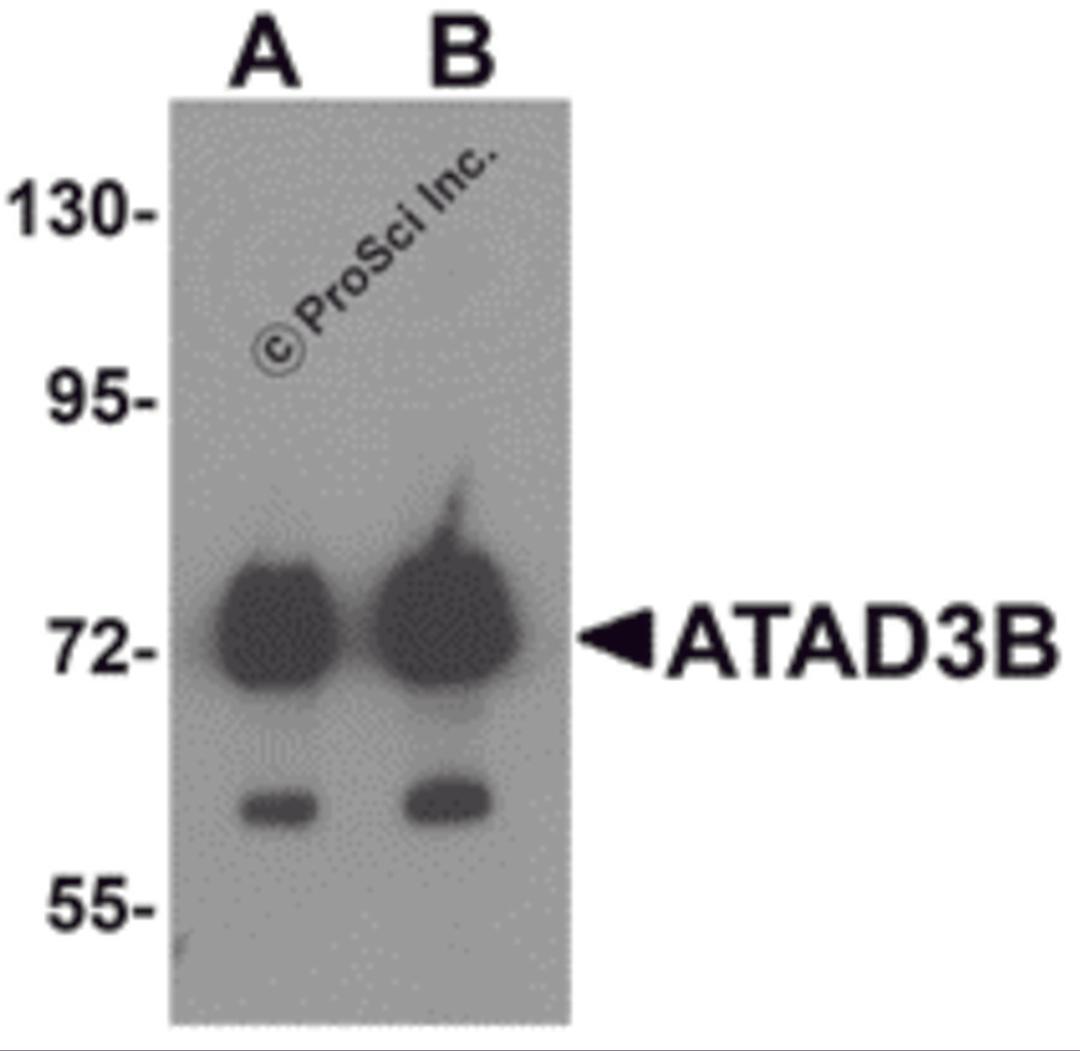 Western blot analysis of ATAD3B in human kidney tissue lysate with ATAD3B antibody at (A) 1 and (B) 2 μg/mL .