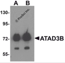Western blot analysis of ATAD3B in human kidney tissue lysate with ATAD3B antibody at (A) 1 and (B) 2 μg/mL .