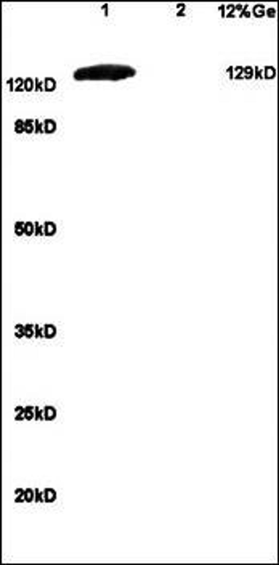 Western blot analysis of mouse brain lysates (Lane1), mouse embryo lysates (Lane2) dilution at:1:200 using GRM1 antibody