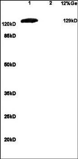 Western blot analysis of mouse brain lysates (Lane1), mouse embryo lysates (Lane2) dilution at:1:200 using GRM1 antibody