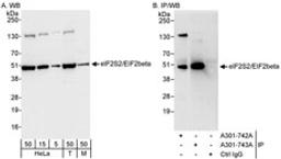 Detection of human and mouse eIF2beta/EIF2S2 by western blot (h&m) and immunoprecipitation (h).