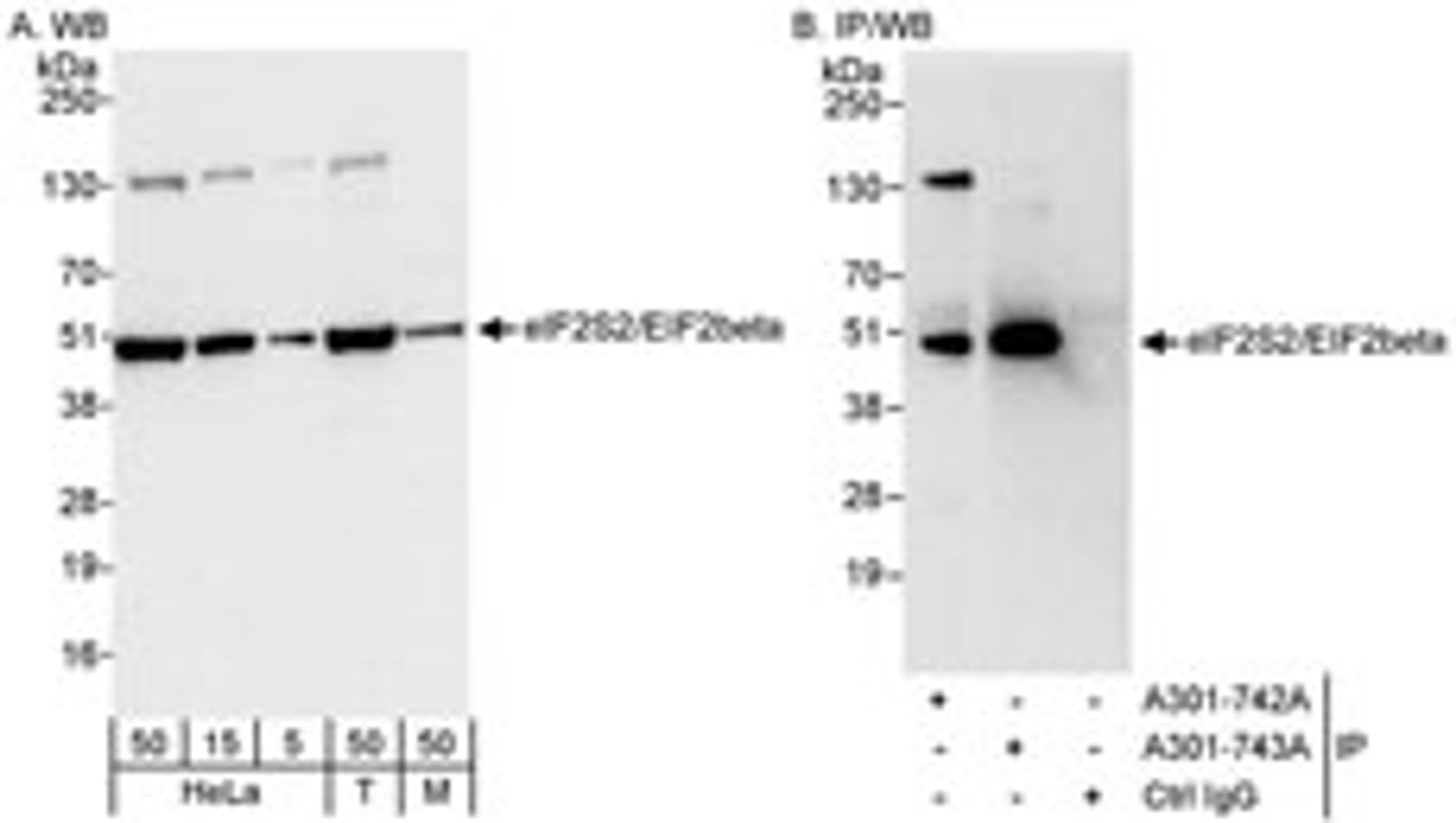 Detection of human and mouse eIF2beta/EIF2S2 by western blot (h&m) and immunoprecipitation (h).