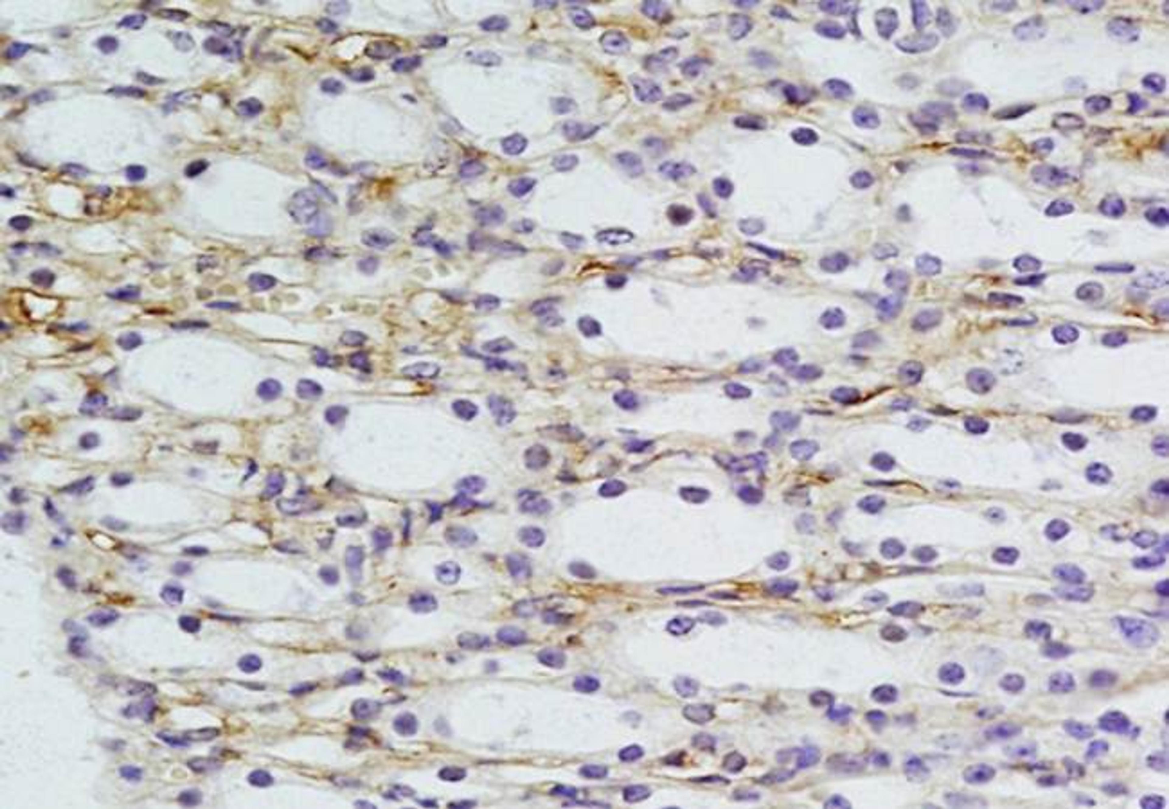 IHC-P of mouse kidney tissue using LRIG2 antibody (Dilution at :1:200)