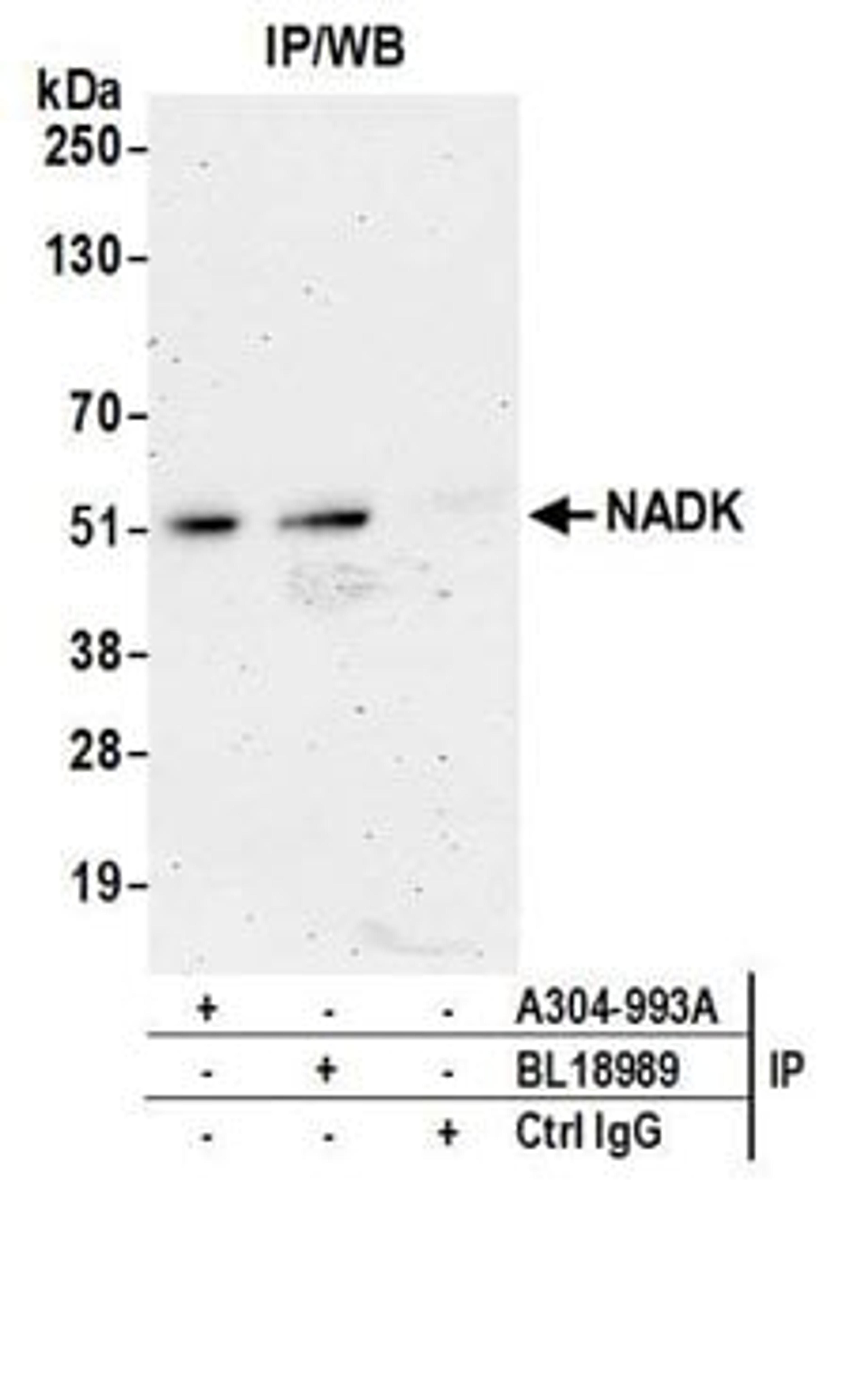 Detection of human NADK by western blot of immunoprecipitates.