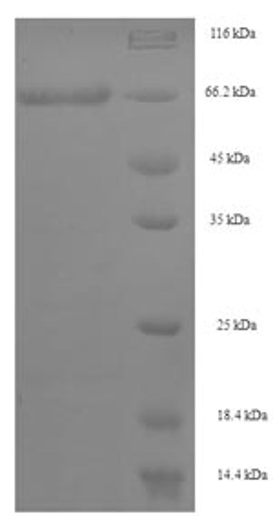 (Tris-Glycine gel) Discontinuous SDS-PAGE (reduced) with 5% enrichment gel and 15% separation gel.