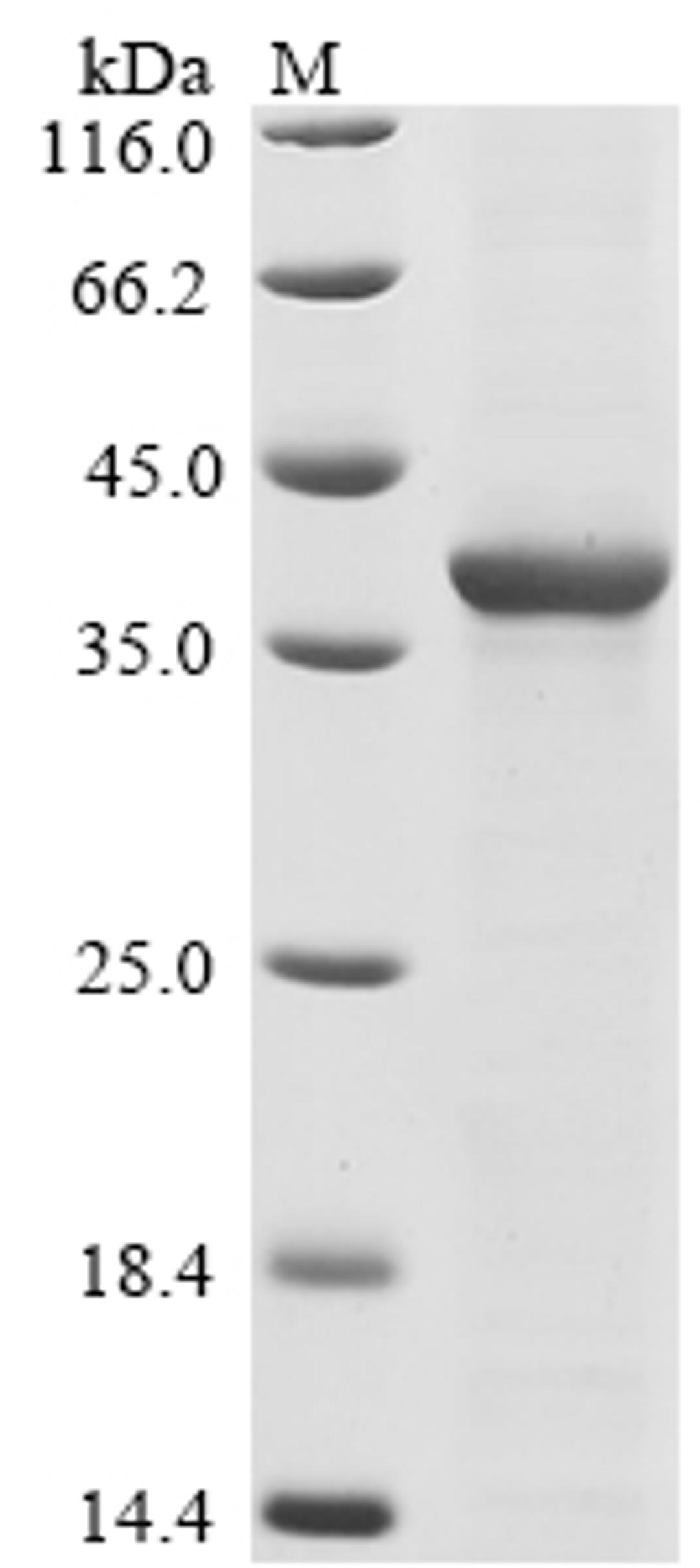 (Tris-Glycine gel) Discontinuous SDS-PAGE (reduced) with 5% enrichment gel and 15% separation gel.
