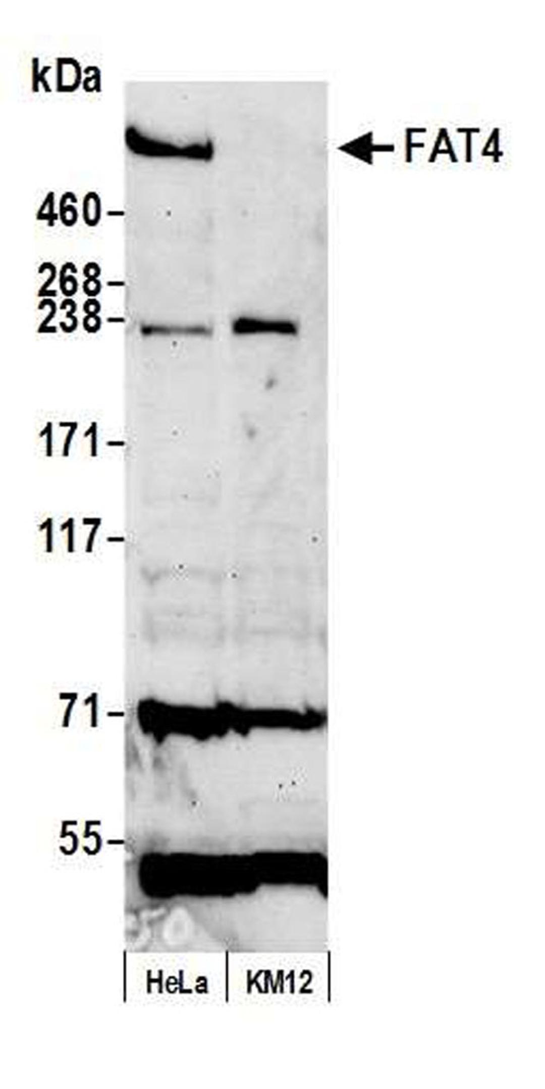 Detection of human FAT4 by WB.