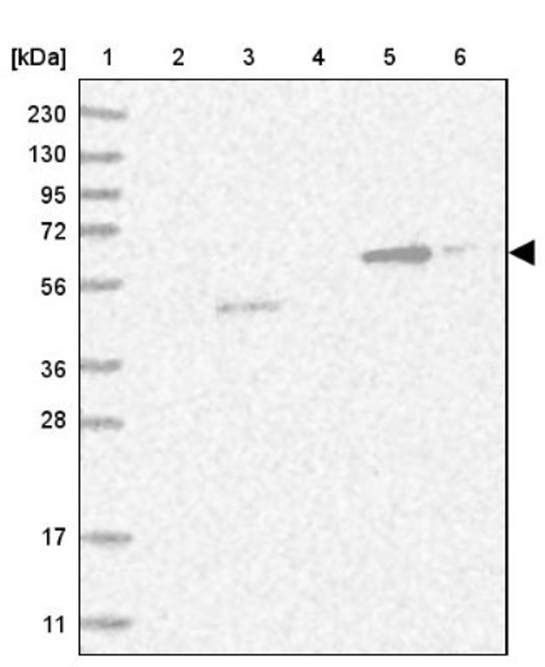 Western Blot: CRISPLD2 Antibody [NBP1-85143] - Lane 1: Marker [kDa] 230, 130, 95, 72, 56, 36, 28, 17, 11<br/>Lane 2: Human cell line RT-4<br/>Lane 3: Human cell line U-251MG sp<br/>Lane 4: Human plasma (IgG/HSA depleted)<br/>Lane 5: Human liver tissue<br/>Lane 6: Human tonsil tissue