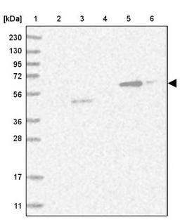 Western Blot: CRISPLD2 Antibody [NBP1-85143] - Lane 1: Marker [kDa] 230, 130, 95, 72, 56, 36, 28, 17, 11<br/>Lane 2: Human cell line RT-4<br/>Lane 3: Human cell line U-251MG sp<br/>Lane 4: Human plasma (IgG/HSA depleted)<br/>Lane 5: Human liver tissue<br/>Lane 6: Human tonsil tissue