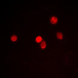 Immunofluorescense analysis of Hela cells using RACK7 antibody