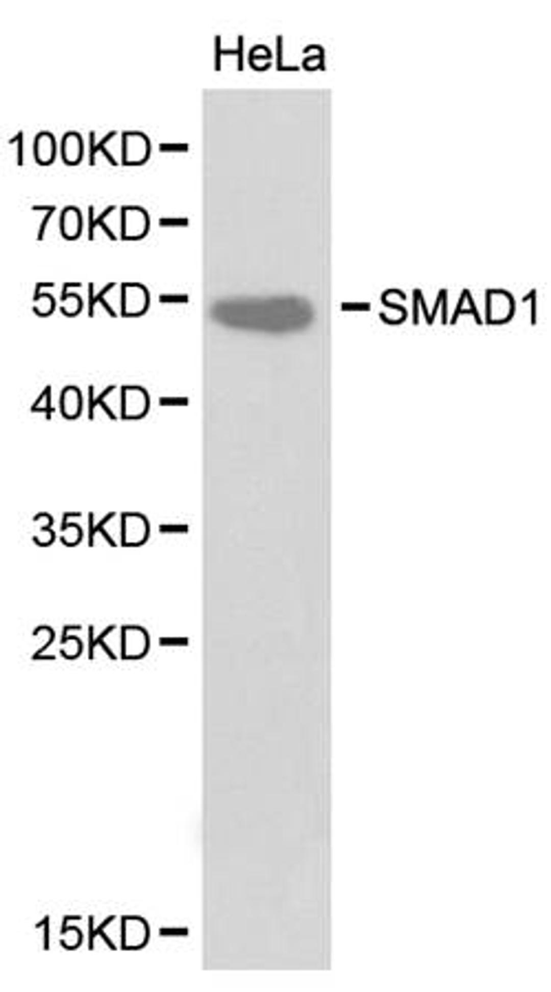 Western blot analysis of hela cell line lysates using SMAD1 antibody