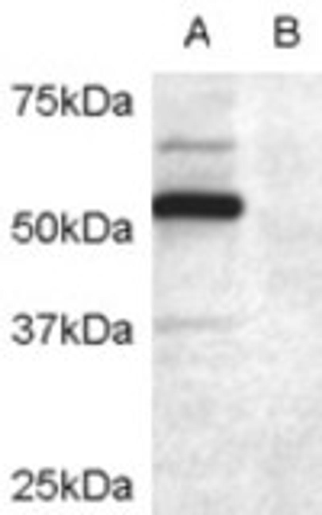 45-464 (0.2ug/ml) staining of COS7 cell lysate transfected with full length recombinant human DCDC2 (A) and untransfected control COS7 cells (B). Primary incubation was 1 hour. Detected by chemiluminescence.