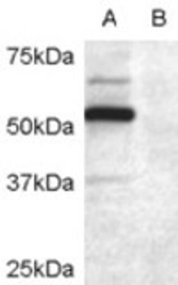 45-464 (0.2ug/ml) staining of COS7 cell lysate transfected with full length recombinant human DCDC2 (A) and untransfected control COS7 cells (B). Primary incubation was 1 hour. Detected by chemiluminescence.