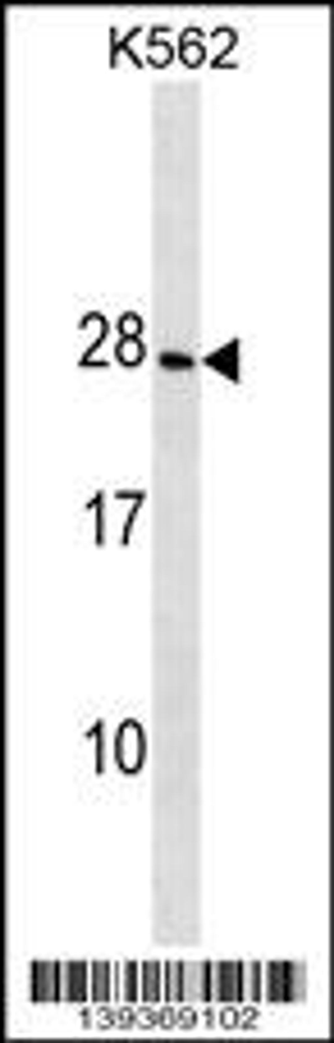 Western blot analysis in K562 cell line lysates (35ug/lane).