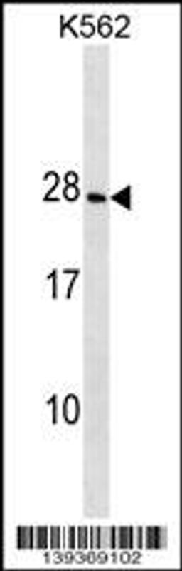 Western blot analysis in K562 cell line lysates (35ug/lane).