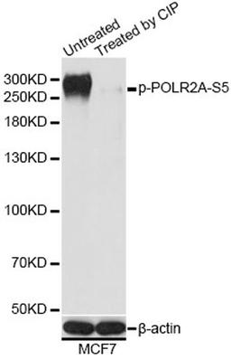 Western blot - Phospho-POLR2A-S5 antibody (AP0828)