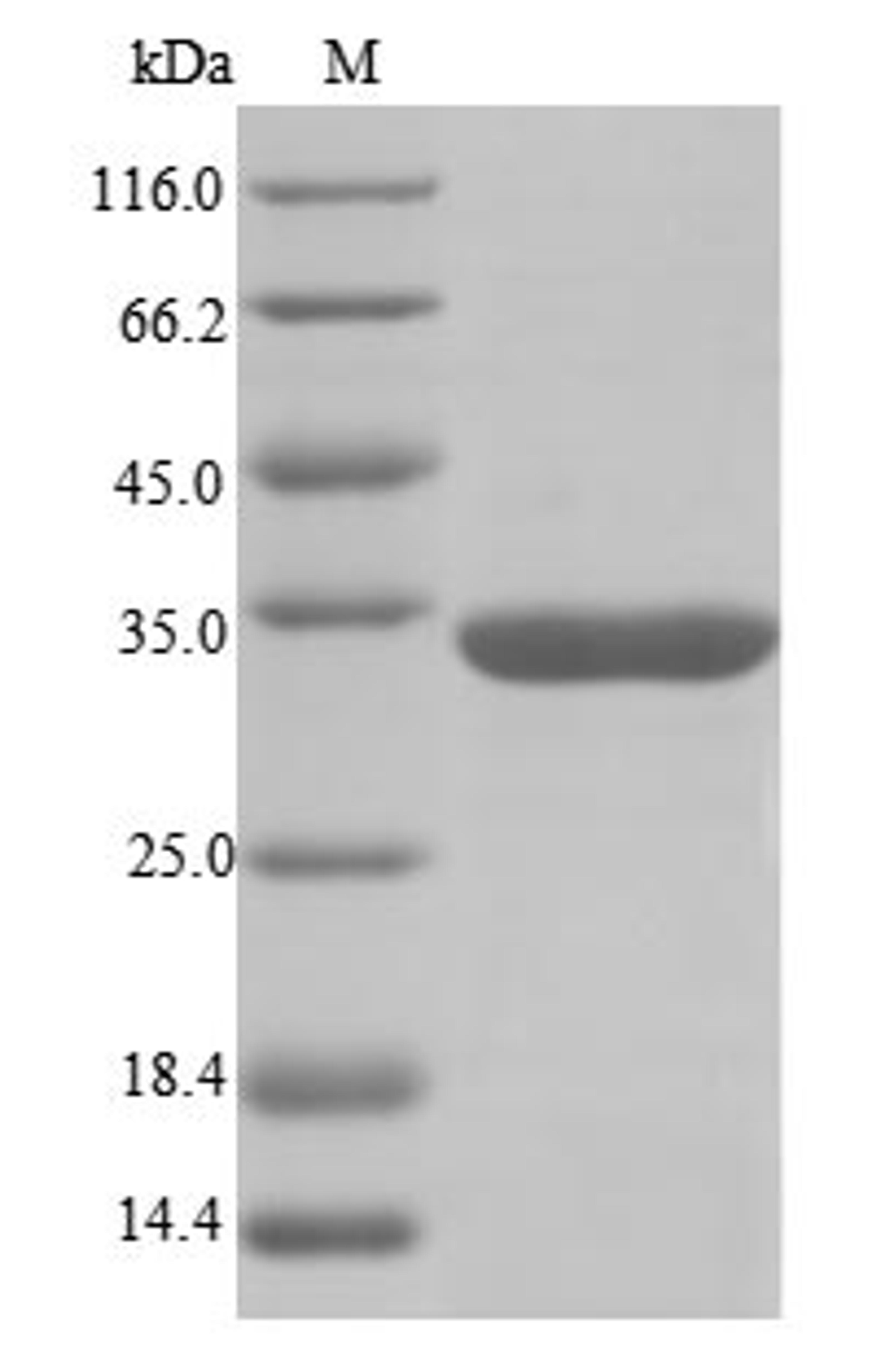 (Tris-Glycine gel) Discontinuous SDS-PAGE (reduced) with 5% enrichment gel and 15% separation gel.