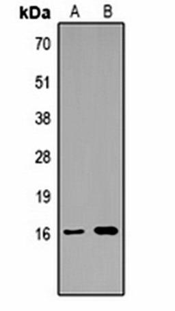 Western blot analysis of  Hela (Lane1), rat testis (Lane2) whole cell lysates using Histone H3 (TriMethyl K14) antibody