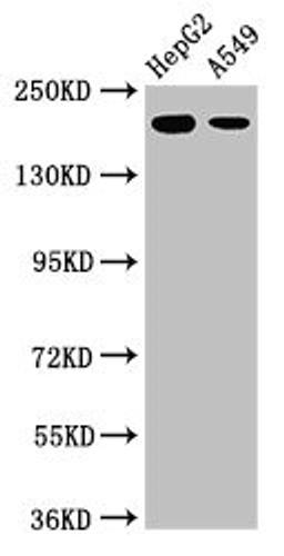 Western Blot. Positive WB detected in: HepG2 whole cell lysate, A549 whole cell lysate. All lanes: LRRK1 antibody at 3ug/ml. Secondary. Goat polyclonal to rabbit IgG at 1/50000 dilution. Predicted band size: 226, 29 kDa. Observed band size: 226 kDa. 