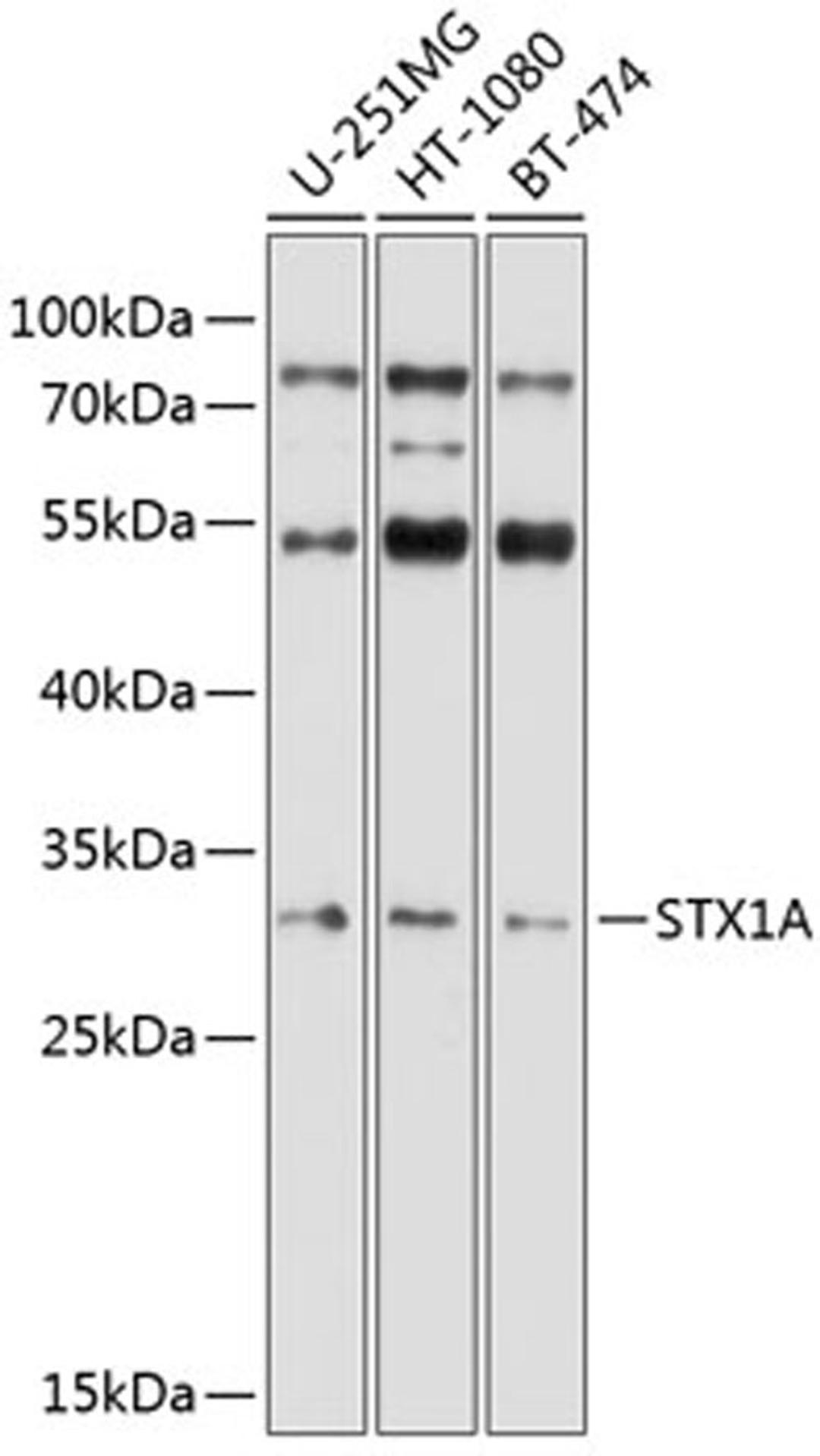 Western blot - STX1A antibody (A5570)