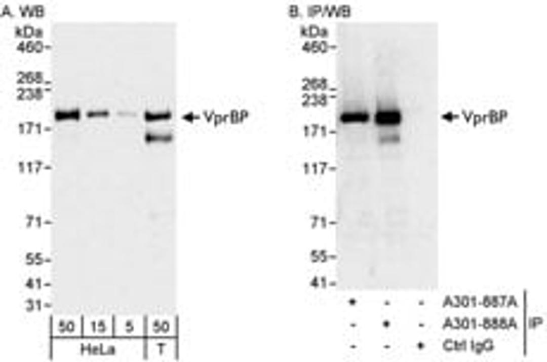 Detection of human VprBP by western blot and immunoprecipitation.