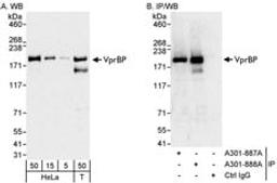 Detection of human VprBP by western blot and immunoprecipitation.