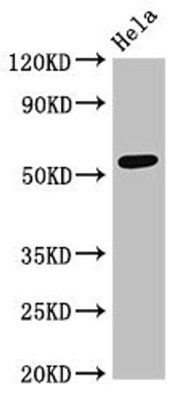 Western Blot. Positive WB detected in: Hela whole cell lysate. All lanes: PTBP2 antibody at 4ug/ml. Secondary. Goat polyclonal to rabbit IgG at 1/50000 dilution. Predicted band size: 58, 59, 38, 39 kDa. Observed band size: 58 kDa. 