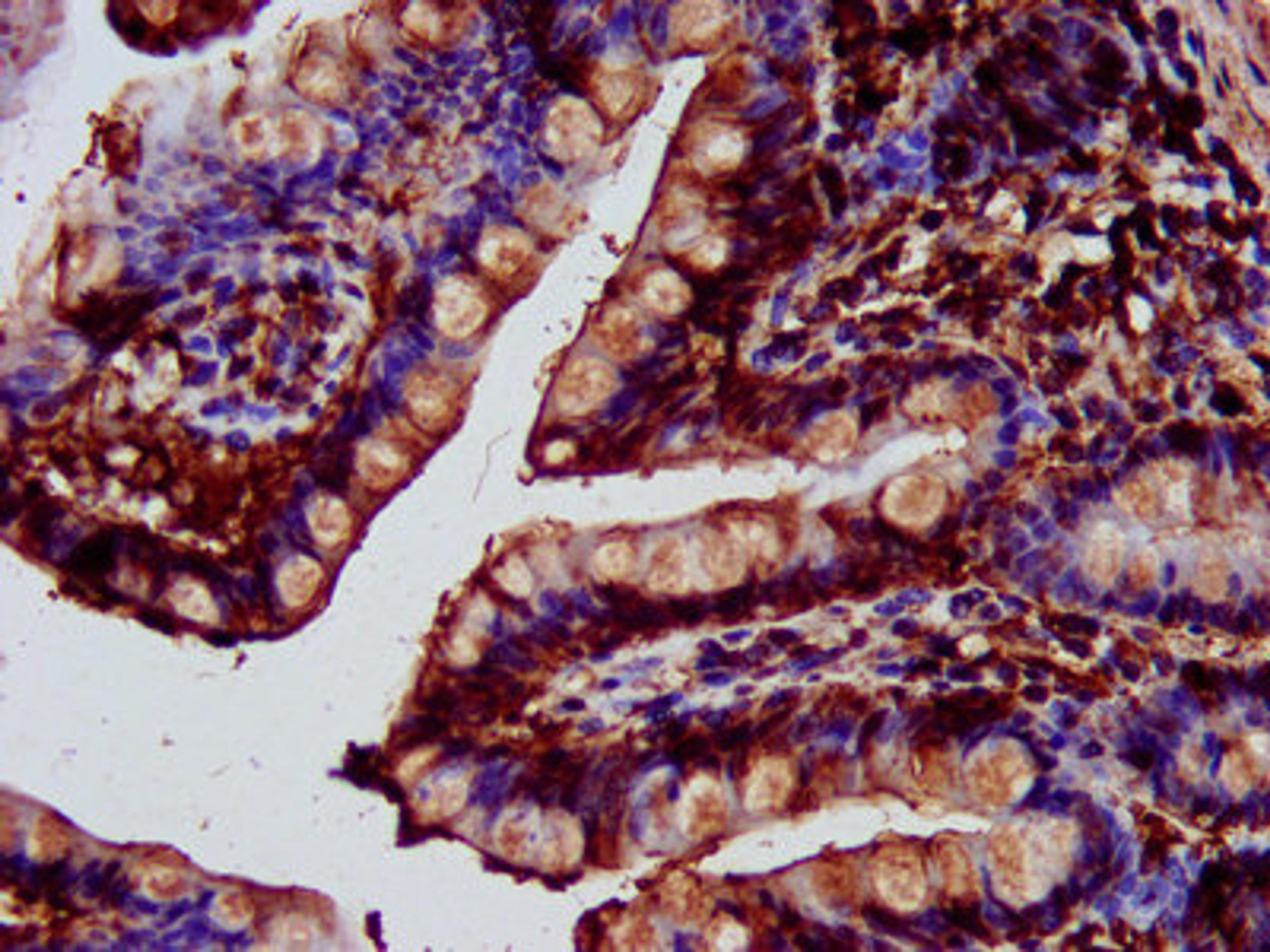 IHC image of CSB-PA836208LA01HU diluted at 1:400 and staining in paraffin-embedded human small intestine tissue performed on a Leica BondTM system. After dewaxing and hydration, antigen retrieval was mediated by high pressure in a citrate buffer (pH 6.0). Section was blocked with 10% normal goat serum 30min at RT. Then primary antibody (1% BSA) was incubated at 4&deg;C overnight. The primary is detected by a biotinylated secondary antibody and visualized using an HRP conjugated SP system.