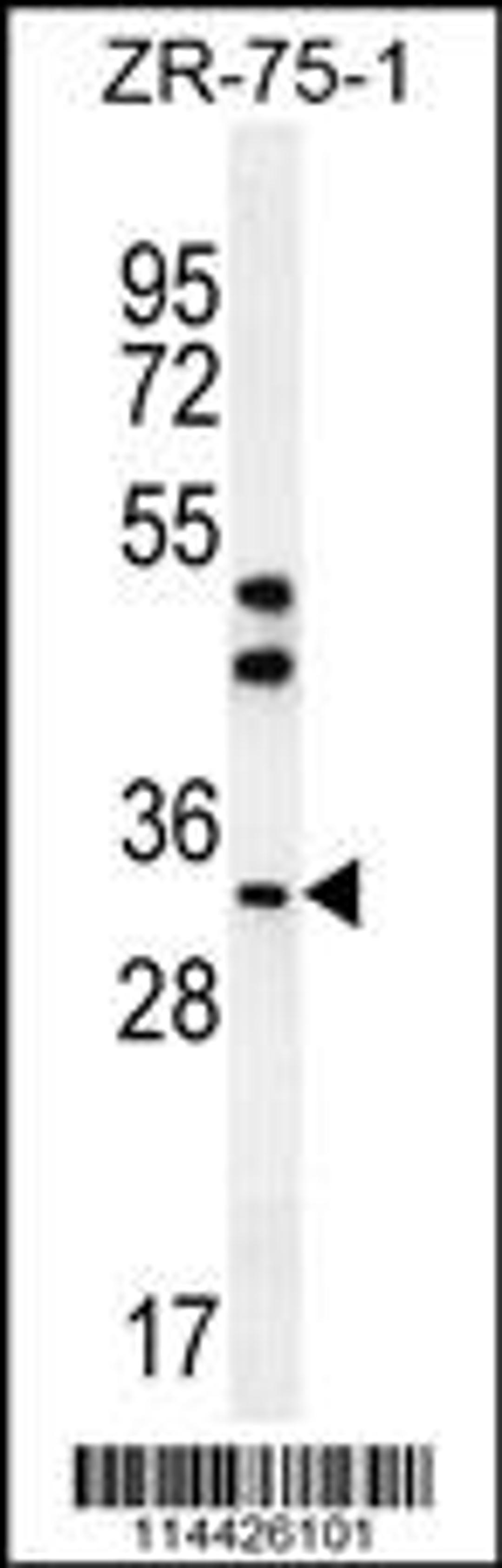 Western blot analysis in ZR-75-1 cell line lysates (35ug/lane).