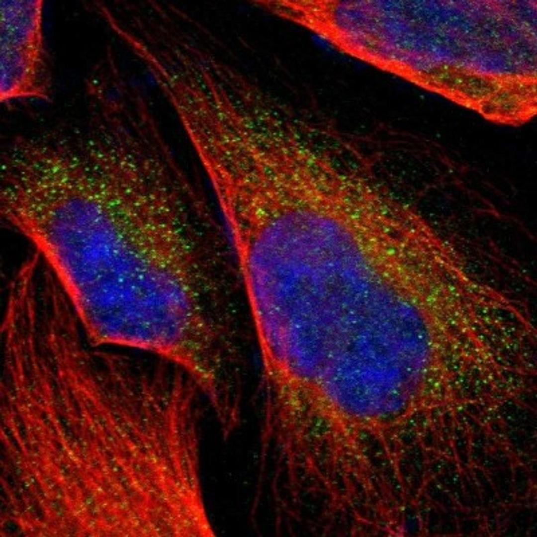 Immunofluorescence: RAB39B Antibody [NBP1-85819] - Immunofluorescent staining of human cell line U-2 OS shows positivity in cytoplasm.