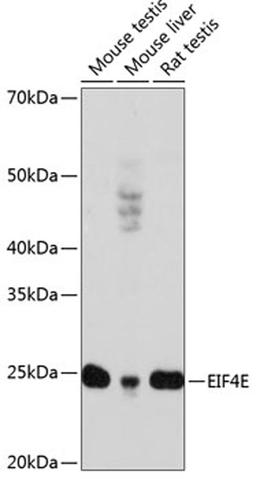 Western blot - EIF4E antibody (A19044)